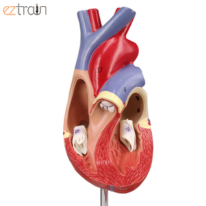 Modelo de Aterosclerosis Cardíaca de 4 Etapas, Enfermedad de las Arterias Coronarias, Material de PVC+ABS, 2 Partes Desmontables para Fines Científicos - Product Image 3