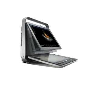 Escáner de Ultrasonido Portátil para Animales Sonoscape S9V de Alto Rendimiento para Diagnóstico en Granjas, Ganado y Clínicas Veterinarias - Product Image 6