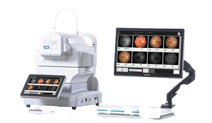 كاميرا قاع العين حار بيع RetiCam 3100 معدات طب العيون الصانع غير mydriatic العين الرقمية كاميرا قاع العين ophthalmoloy - Product Image 2