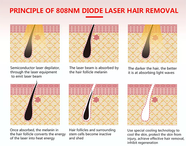 SA-DP01 2022 multifunction laser hair removal diode laser hair removal machine 808nm