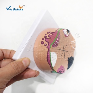 बच्चों के लिए त्वचा कैंसर शारीरिक शिक्षा मॉडल मैनिकिन प्लास्टिक/पीसी - Product Image 6