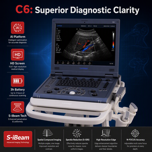 Dispositivo de Imagenología Clínica Digital Profesional, Sistema de Ultrasonido Doppler a Color Portátil tipo Laptop C6pro-02 Advanced Trueview - Product Image 1