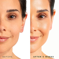 Sérum Visage Liquide OEM Vitamine C Acide Hyaluronique Éclaircissant Hydratant Nourrissant Apaisant Sans Parfum Anti-Taches Brunes
