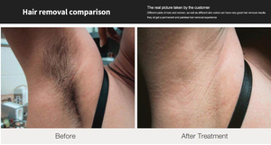 Appareil d'épilation au <span class=keywords><strong>laser</strong></span> à diode verticale <span class=keywords><strong>soprano</strong></span> 808 nm, appareil d'épilation au <span class=keywords><strong>laser</strong></span> indolore, adapté aux salons de beauté - Product Image 5