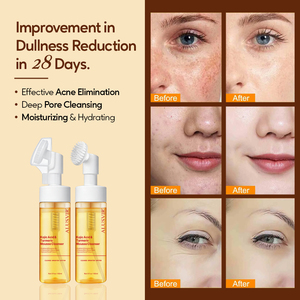 Limpiador Facial Líquido Espumoso Coreano con Cúrcuma, Caléndula y Ácido Kójico, Antiacné, Productos <span class=keywords><strong>para</strong></span> el Cuidado de <span class=keywords><strong>la</strong></span> Piel del Rostro - Product Image 6