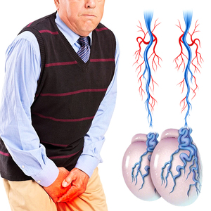 Pommade à base de plantes Wangtailin pour la varicocèle, la vascularite et les varices des <span class=keywords><strong>jambes</strong></span>, apaisante et hypoallergénique - Product Image 2