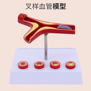 Modelo de anatomía vascular humana; modelo vascular; demostración de arteriosclerosis; vasos sanguíneos en diferentes etapas de edad. - Product Image 1