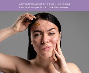 สารสกัดจากกรด DL-mandelic 30% 100มล. ช่วยผลัดเซลล์ผิวต่อต้านสิวรูขุมขนเหมาะสำหรับผิวมัน - Product Image 3