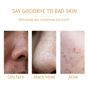 Etiqueta privada Orgánica Anti Acné Lavado DE CARA Aloe Vera Infundido Burbuja Espuma Removedor de cabeza negra Limpiador facial de cúrcuma vegana - Product Image 2