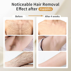 Moolweel T001i Máquina IPL Profesional de Mano para Uso Doméstico, Depilación Láser Intensa Indolora con Enfriamiento Eléctrico para el Cuerpo - Product Image 4