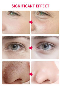 Sérum pour le visage de haute qualité à la racine de betterave et à la vitamine A, marque privée, anti-âge, anti-rides, hydratant - Product Image 4