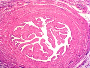 100個の人間の顕微鏡写真組織学準備スライドセット標本顕微鏡準備スライド医学生学習用 - Product Image 3