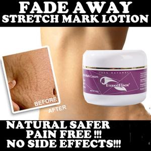 Crème Réparatrice Visage et Corps Anti-Vergetures et Cicatrices de Grossesse au Beurre de Karité et Vitamine B5 - Product Image 6