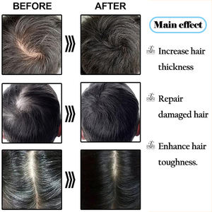 Suero para el Crecimiento del Cabello con Péptidos, Cuidado del Cuero Cabelludo, Nutre y Calma el Cuero Cabelludo, y Mejora la Vitalidad de los Folículos Pilosos - Product Image 3