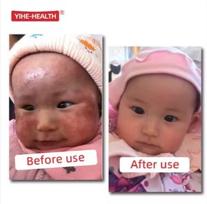 Krim Eksim Bayi MeiZheng 15g, Disetujui Dokter Anak, Herbal Antibakteri, Pereda Gatal Kulit untuk Ruam Panas, Ruam Popok, Plester Cina - Product Image 2