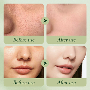 OEM SADOER - Loción Hidratante de Aguacate y Mascarilla <span class=keywords><strong>Facial</strong></span> Más Vendida, Reduce las Arrugas, el Acné, Aclara la <span class=keywords><strong>Piel</strong></span>, Repara la <span class=keywords><strong>Piel</strong></span>, Set de Cuidado de la <span class=keywords><strong>Piel</strong></span> - Product Image 6