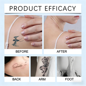 Cuidado Posterior al Tatuaje, Aceite Esencial para el Cuidado <span class=keywords><strong>de</strong></span> la Piel con Aroma a Limón, Calmante, Reparador e Hidratante - Product Image 6