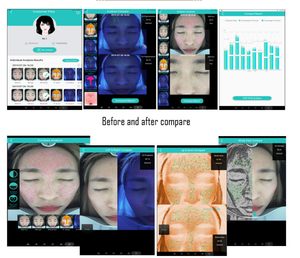 Analyse professionnelle de la peau du visage par miroir numérique 3D AI, détection des rides et analyse des cheveux, écran tactile LED de 15 pouces - Product Image 6