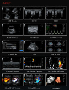 Ultrasoundapparaat trolley/<span class=keywords><strong>3D</strong></span> <span class=keywords><strong>4D</strong></span> kleuren <span class=keywords><strong>Doppler</strong></span> ultrasoundapparaat voor ziekenhuis en kliniek - Product Image 6