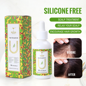 Aceite Herbal para el Crecimiento del Cabello con Cebolla y Romero, Marca Privada OEM, para Cabello Rizado y Fino, Fórmula 2 en <span class=keywords><strong>1</strong></span> Sin Silicona - Product Image 5