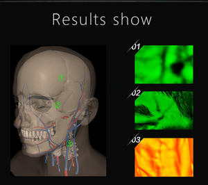 MC409 Pencari Vena Inframerah Portabel Paling Hemat Biaya dengan Lensa IR 1080P untuk Menunjukkan Gambar Pembuluh Darah Di Komputer - Product Image 6