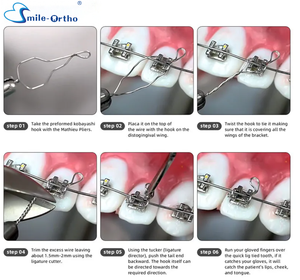 Corbatas dentales <span class=keywords><strong>Kobayashi</strong></span> Shorty, alambres de ligadura <span class=keywords><strong>Kobayashi</strong></span> de ortodoncia, alambres de ligadura de acero inoxidable, materiales de odontología - Product Image 2