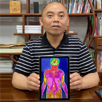 Caméra thermique infrarouge numérique, technique d'imagerie thermique non invasive