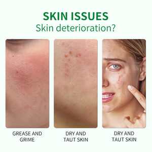 Natuurlijke Kruiden Aloë <span class=keywords><strong>Vera</strong></span> <span class=keywords><strong>Gel</strong></span> Gezichtslichaam Kalmerende Hydraterende Zon Reparatie Mee-Eter Verwijderen Grote Poriën Litteken Zorg Oem Alle Huid - Product Image 3