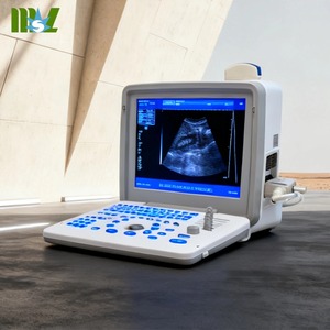 Cầm tay echograph máy 3.5MHz thăm dò tần số di động echograph xách tay ultrasosund máy - Product Image 1