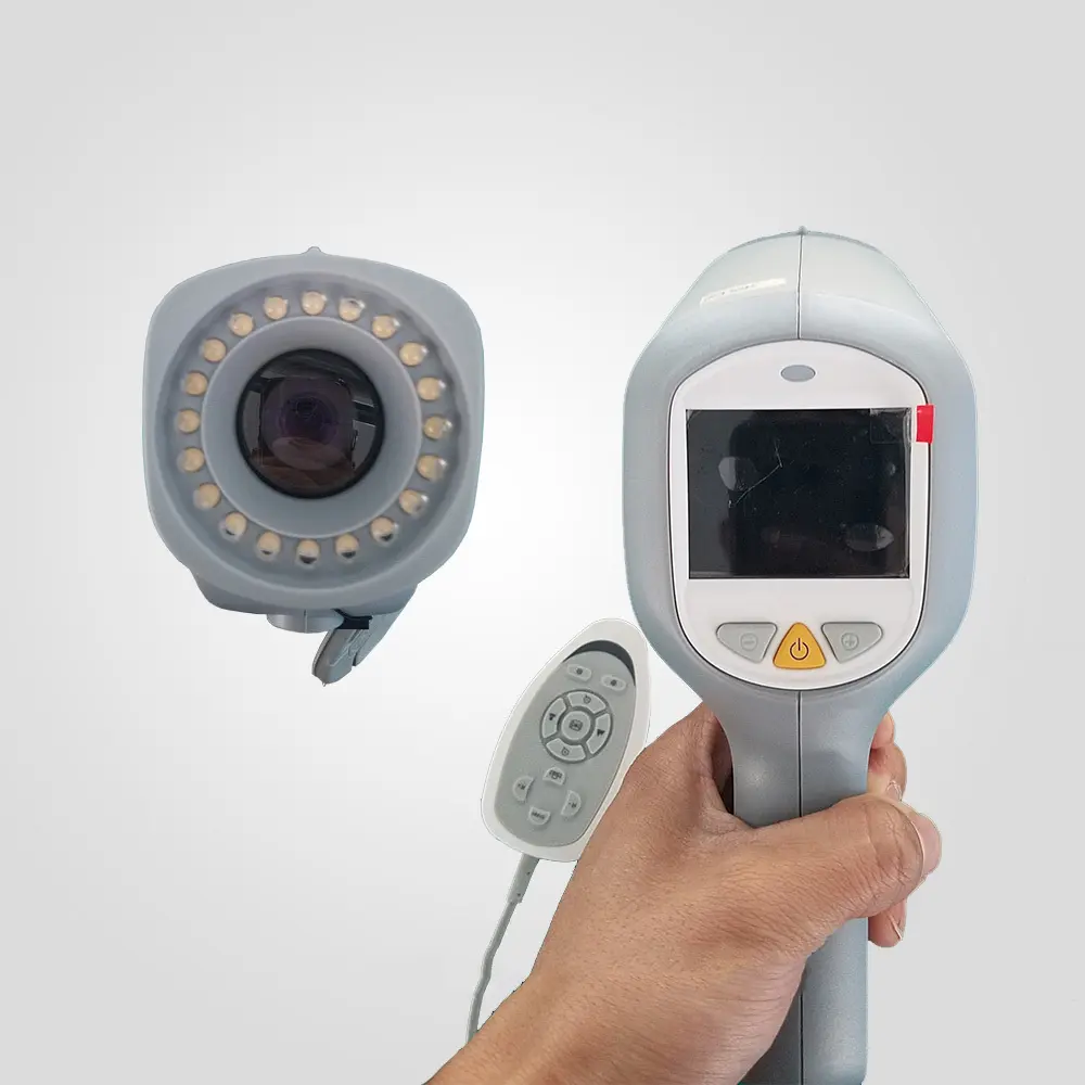 2024 New Kernel Colposcope Manufactures Vaginoscope Digital Video Colposcope for Gynecology Colposcopy