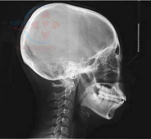 مستعملة عالية التردد ProMax Pano و Ceph - Product Image 5