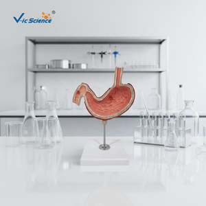 Modelli Anatomici per l'Insegnamento Medico: Modello di Stomaco con <span class=keywords><strong>Ulcere</strong></span>, Modello Anatomico del Sistema Digestivo - Product Image 2