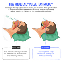 Produits les plus vendus Portable EMS Pulse Stop Ronflement Outil d'aide au sommeil Dispositif anti-ronflement intelligent