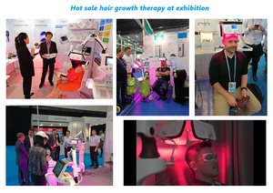 KN-8000A de núcleo potente para la pérdida de cabello, diodos láser de 650nm para el crecimiento del cabello, máquina para la pérdida de cabello, Alopecia <span class=keywords><strong>Areata</strong></span> seborreica - Product Image 2