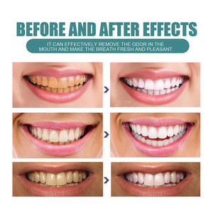 UUKKG <span class=keywords><strong>Dentifrice</strong></span> Menthe Fraîcheur 75g Usage Domestique Élimine <span class=keywords><strong>les</strong></span> <span class=keywords><strong>Taches</strong></span> Produit Blanchissant pour Soins Bucco-Dentaires - Product Image 5