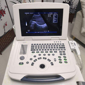 Ecógrafo Doppler Color Inalámbrico de Mano con Doble Sonda, Escáner de Ultrasonido Médico Portátil - Product Image 3