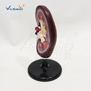 Modèle d'anatomie rénale, modèle de structure rénale humaine, aide pédagogique pour la démonstration en urologie - Product Image 3