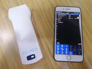 192 요소 고급 휴대용 혈관 초음파 스캐너 대퇴사 두근 햄스트링 수의학 CU14 - Product Image 3