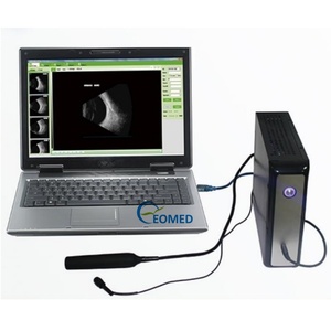 Appareil d'échographie ophtalmique A/B le moins cher pour la pratique ophtalmique, scanner ScanBox EUS500T - Product Image 1
