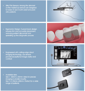 Nuove apparecchiature per sensori dentali/tecnologia di Imaging USB porta Imaging intraorale - Product Image 5