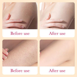 Crema Corporal Suavizante con Extracto de Plantas para Mejorar la Opacidad y Eliminar las Pielcitas de Gallina, Loción Corporal Blanqueadora e Iluminadora - Product Image 4