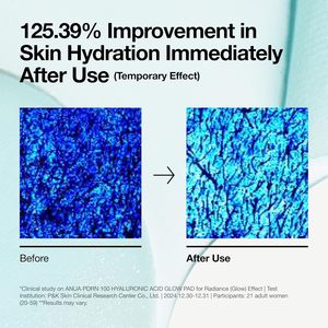 Anua Glow Pad 60 Unidades 180 ml Tónico Facial con PDRN y Ácido Hialurónico - Product Image 6