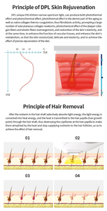 Máquina de Rejuvenecimiento de Precisión DPL+ para Eliminación de Vello, Manchas y Células Rojas, 550-650nm, Eliminación de Rojeces - Product Image 4