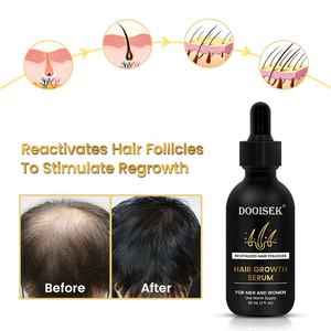 Suero para el cabello Tratamiento reparador para el cuidado del cuero cabelludo Tratamiento antipérdida de cabello Nuevo aceite esencial orgánico para el crecimiento del cabello para mujeres y hombres - Product Image 3