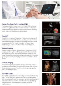 Sonosape P25Elite troli warna Digital, pemindai Ultrasound resolusi tinggi 3D/4D/5D dengan Diagnosis bantuan AI - Product Image 4