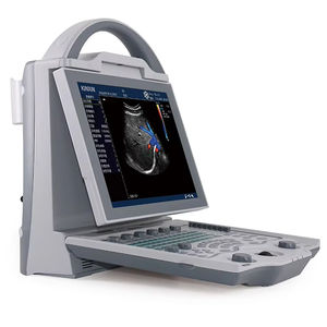 Escáner de Ultrasonido <span class=keywords><strong>Doppler</strong></span> Color para Diagnóstico Veterinario, con Monitor LCD de 10.4 Pulgadas sin Necesidad de Lavado, Certificado ISO - Product Image 1