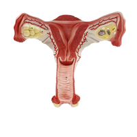 Modèle anatomique de l'utérus et des ovaires féminins humains KyrenMed KR-UM03, utérus normal, ovaires, système reproducteur, science médicale