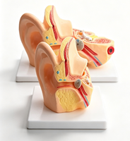 Modèle anatomique pédagogique du système reproducteur féminin avec modifications pathologiques (utérus, ovaires) pour les écoles de médecine