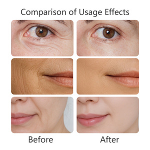 Suero Antiarrugas de Marca Privada con Retinol y Multipéptidos para Penetrar en la Capa Dérmica y Acelerar la Renovación de la Piel - Product Image 4