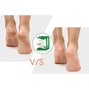 Masque exfoliant pour les pieds, livraison gratuite, OEM /ODM, exfoliant pour bébés, enlève les peaux mortes, chaussettes, spa, exfoliant, marque privée - Product Image 5